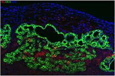 ایجاد ارگانوئیدهای کلیوی از سلول های iPS برای مدل سازی نفروژنز انسانی