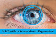 سلول های چشمی مشتق از سلول های بنیادی برای درمان شکل شدید تخریب ماکولای مربوط به سن(AMD)