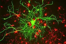تنظیم عملکردی FoxO1 در تمایز سلول های بنیادی عصبی