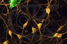 تولید سلول های بنیادی عصبی اولیه از فیبروبلاست های انسانی با استفاده از مجموعه خاصی از فاکتورها