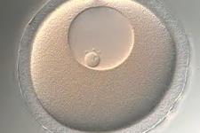 تولید سلول های بنیادی از تخمک های موش های پیر