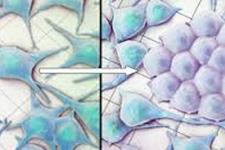 ارتباط بین بازبرنامه ریزی برای تولید سلول های بنیادی و ایجاد سرطان