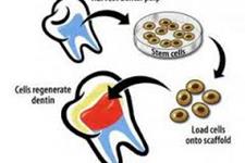 چگونه سلول های بنیادی موجود در دندان شما، زندگی شما را نجات می دهد