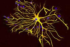 کشف تنوع آستروسیت ها در سیستم عصبی 