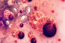 متاستاز سرطان از طریق همجوشی سلول های تومور و سلول های سیستم ایمنی 