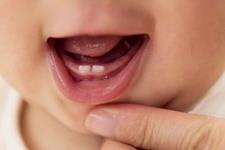 کاربرد سلول‌های بنیادی مزانشیمی مشتق از دندان