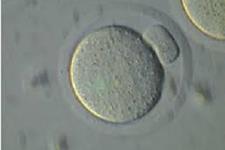 راهی برای حفظ قدرت باروری سلول های تخمک