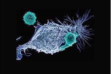 استفاده از سلول‌های CAR T به ‌عنوان حامل داروی سرطان 