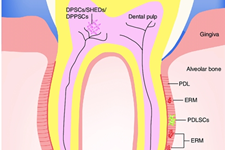 درمان پریودنتیت بوسیله ی سلول‌های بنیادی فولیکول‌های دندانی پیش‌شرطی‌شده با لیپوپلی‌ساکارید