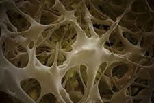 استفاده از سلول های بنیادی مشتق از بافت چربی می تواند بعد از عفونت باکتریایی، بازسازی استخوان را افزایش دهد