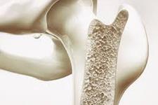 نقش تلومراز در رشد استخوان وابسته به سلول های بنیادی اسکلتی