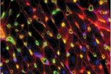 حفاظت نورتروفین-3 از سلول های پیش ساز قلبی عروقی در برای آسیب ناشی از ایسکمی/پرفیوژن مجدد