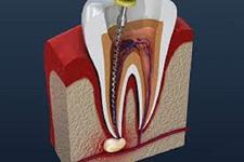 سلول های بنیادی دندانی می توانند سلول های تولید کننده شیر را تولید کنند
