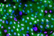 نوع جدیدی از مرگ سلولی در روده‌‌ی مگس کشف شد