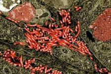 چگونه ویروس ابولا سیستم دفاعی بدن را ناتوان می کند
