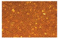 چگونه متابولیسم روی بلوغ سلول های اندوتلیالی مشتق از سلول های iPS تاثیر می گذارد