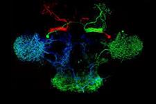 آنزیم مغزی که سلول های بنیادی عصبی خفته را بیدار می کند