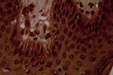 وزیکول های خارج سلولی مشتق از فیبروبلاست های درمی برای تحریک رشد فولیکول مو