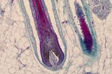 نقش مویرگ های لنفی در کنترل سلول‌های بنیادی فولیکول مو