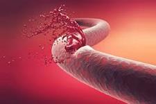 یک رویکرد سلول و ژن درمانی برای درمان اختلالات شایع خونریزی