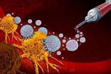نتایج امیدوار کننده ایمنی درمانی برای سرطان سرویکس