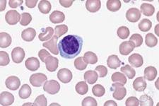 اثبات وجود سلول های لنفوئیدی ذاتی نوزادی در خون