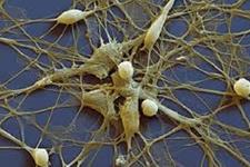 نوروپپتیدی که فقدان آن موجب اختلال در نورون زایی می شود