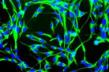 نورون های انتریک مشتق از سلول های بنیادی سیتغ عصبی