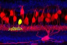 تولید نورون هایی که قابلیت تلفیق شدن به بافت مغز انسانی را دارند