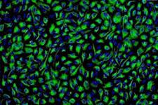 بی خطر بودن سلول های اپی تلیالی رنگ دانه دار مشتق از سلول های بنیادی در مطالعات پیش بالینی