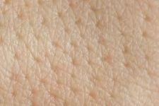 شناسایی مکانیسم هایی که برای تکوین مناسب پوست ضروری هستند