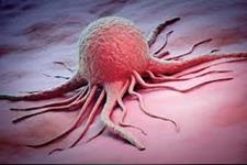 یافته محققان در زمینه دلیل نامیرایی سلول های سرطانی
