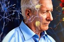 ردیابی چگونگی پیری سلول‌های مغز 