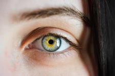 بیماری چشمی ژنتیکی جدیدی کشف شد