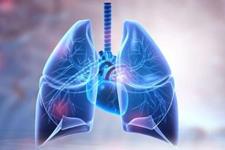 تاییدیه FDA برای دو داروی ترکیبی در درمان آسم 