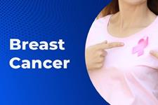 پیش‌بینی سلول‌های B در پاسخ به درمان سرطان پستان 