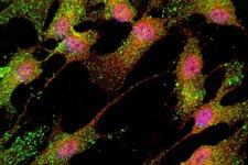 سلول‌ها‌ی بنیادی ممکن است به شناسایی داروهای جدید اسکیزوفرنی کمک کند