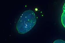 کشف اندامک جدیدی در سلول‌های پستانداران 