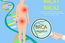 تشخیص سرطان سینه و تخمدان بدون تعیین توالی ژنتیکی