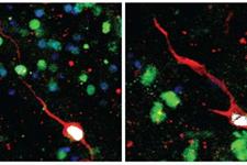 کشف نورون‌های نابالغ در هیپوکامپ مغز انسان