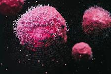 نقش ترانسپوزون‌ها در سرطان