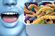 ارتباط بیماری کرون با باکتری‌های موجود در دهان 