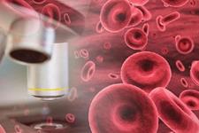 نقش ویتامین B5 در بهبود تولید گلبول قرمز در مبتلایان به سندرم میلودیسپلاستیک 