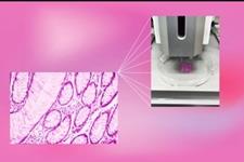 سلول های کشنده طبیعی و  چاپ سه بعدی