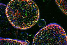 مدل سازی بیماری‌ها با ارائه محصولات جدید کشت سلولی سه بعدی 