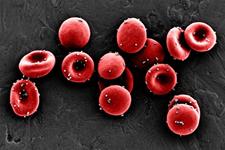 گلبول‌های قرمز اصلاح شده در نقش آنتی‌بیوتیک‌ها 