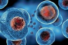 نقش پیوند سلول‌های بنیادی در درمان ام اس