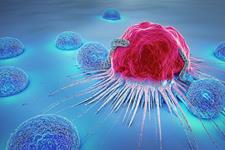 روشن شدن نحوه سرطانی شدن سلول‌های اپیتلیالی