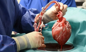 قلب خوک پیوندی در خارج از بدن برای بیش از 24 ساعت زنده می‌ماند