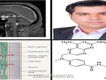 موفقیت محقق ایرانی در تهیه فرمولاسیون جدید درمان سرطان مغز
